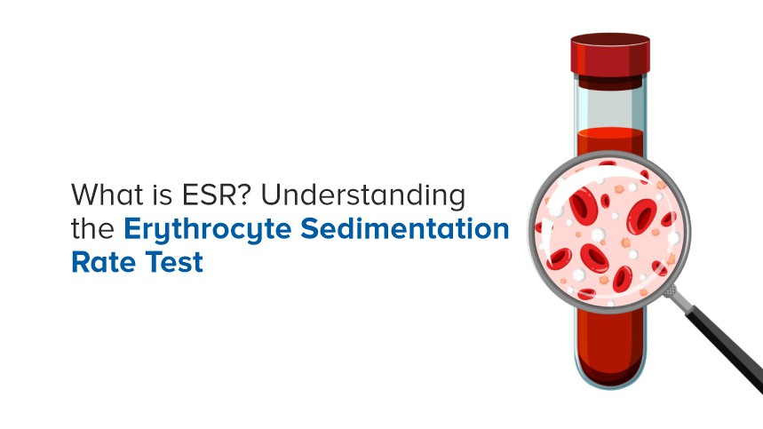 What is ESR? Understanding the Erythrocyte Sedimentation Rate Test